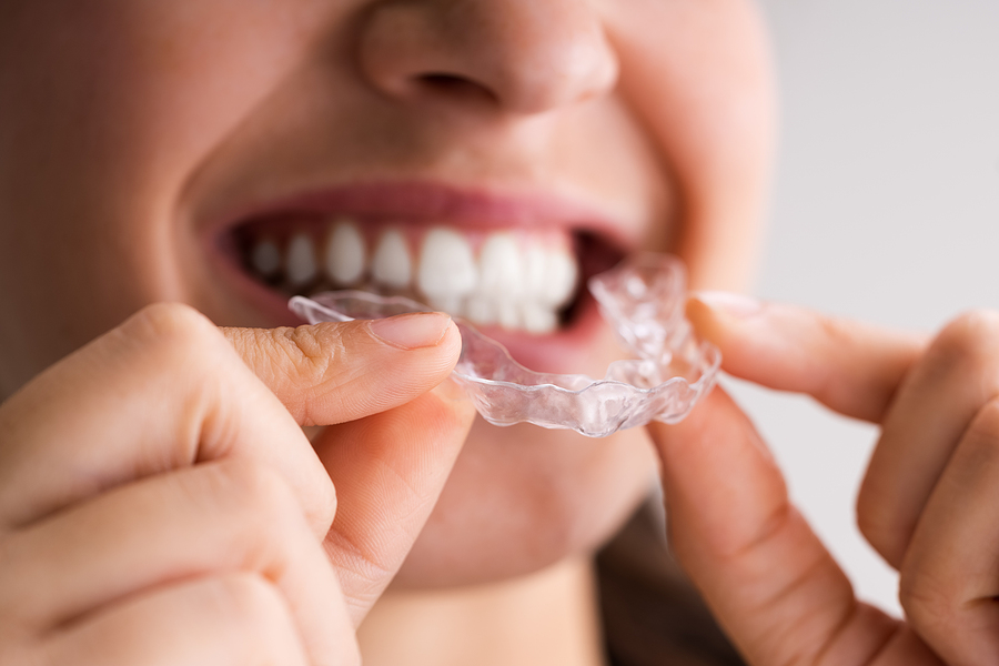 Orthodontics Isn’t Just for Kids: Adults in Braces Are on the Rise
