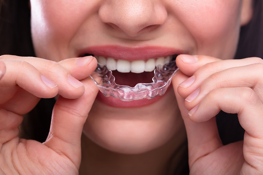 Achieve a Straighter Smile with Clear Aligners in Flat Rock, NC