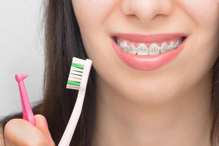 Balancing Braces with a Busy Life: Tips for Working Adults