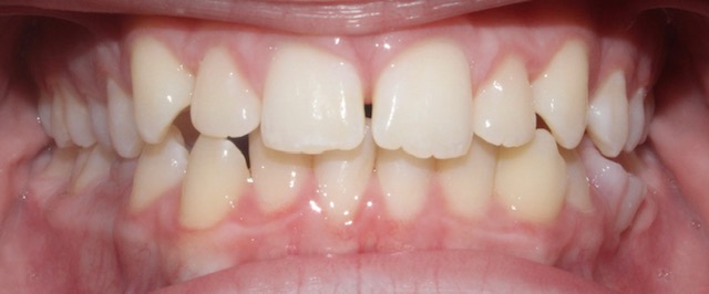 Upwards Orthodontics